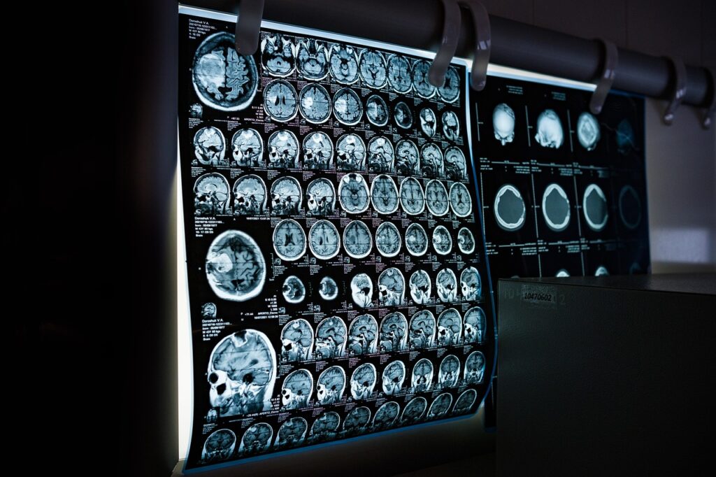X-ray-6841384_1280 ‣ iands What evidence for near-death experiences can we point toward to verify they really happen?